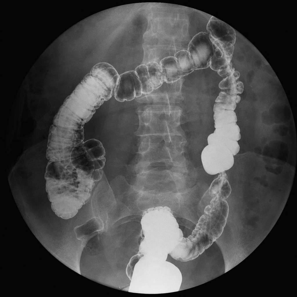 Image for question 45