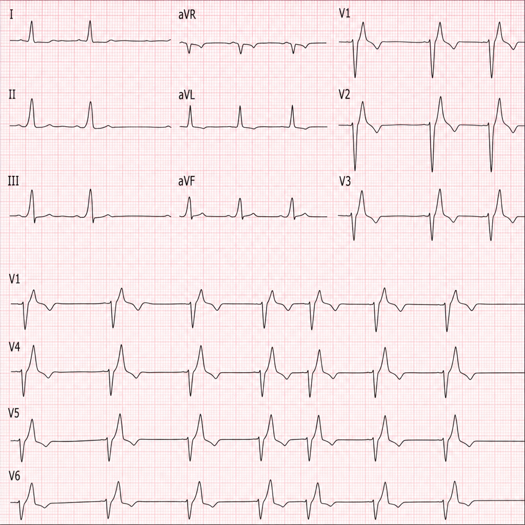 Image for question 119
