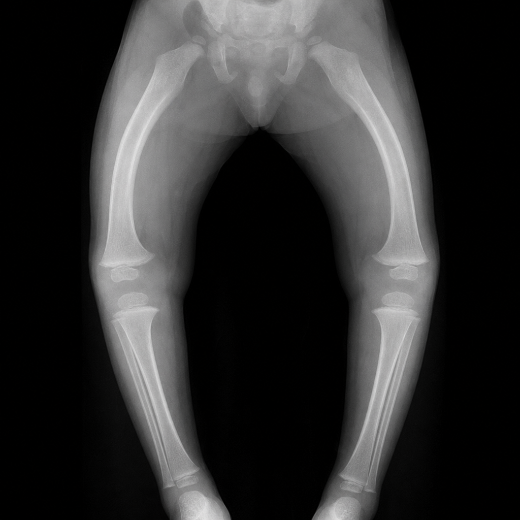 Image for question 362