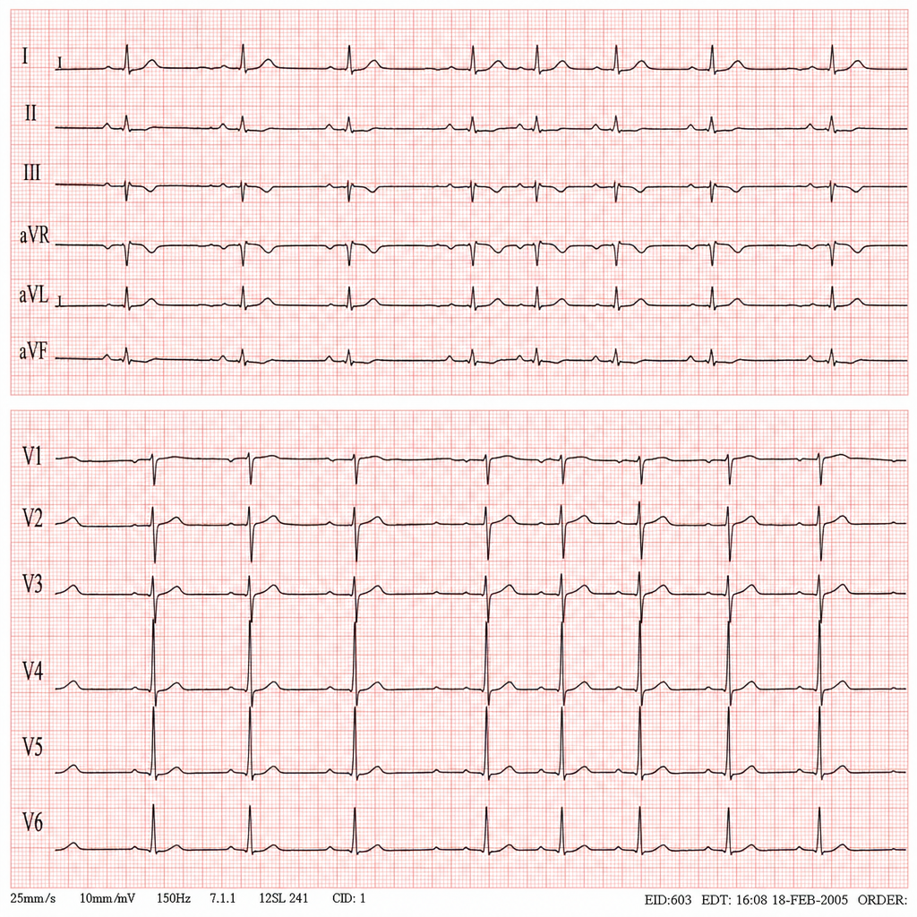 Image for question 3