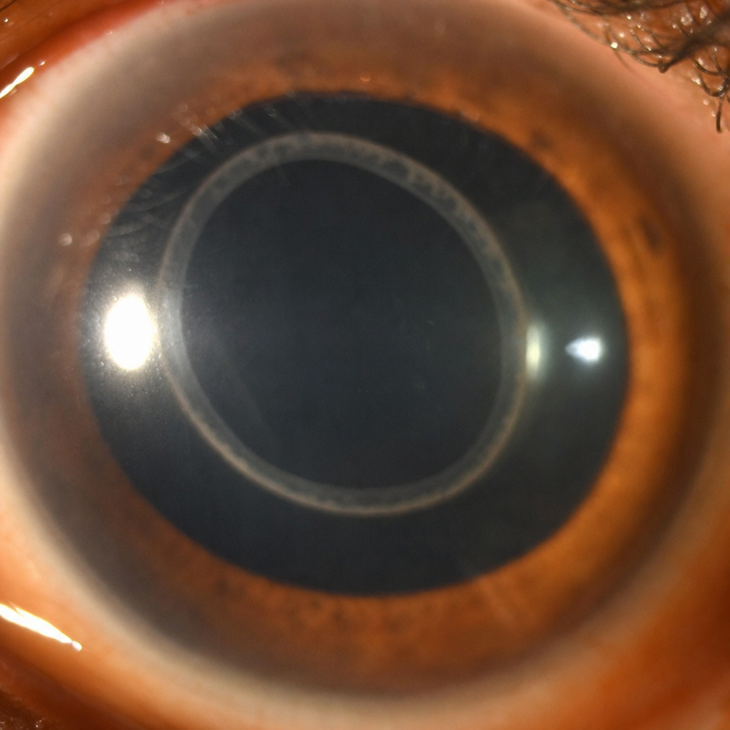 Image for question 204