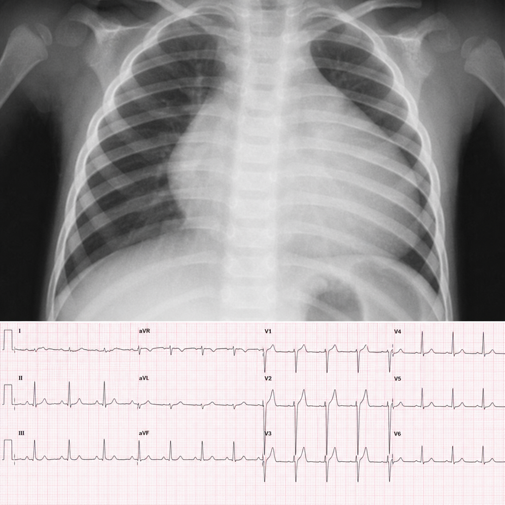 Image for question 144