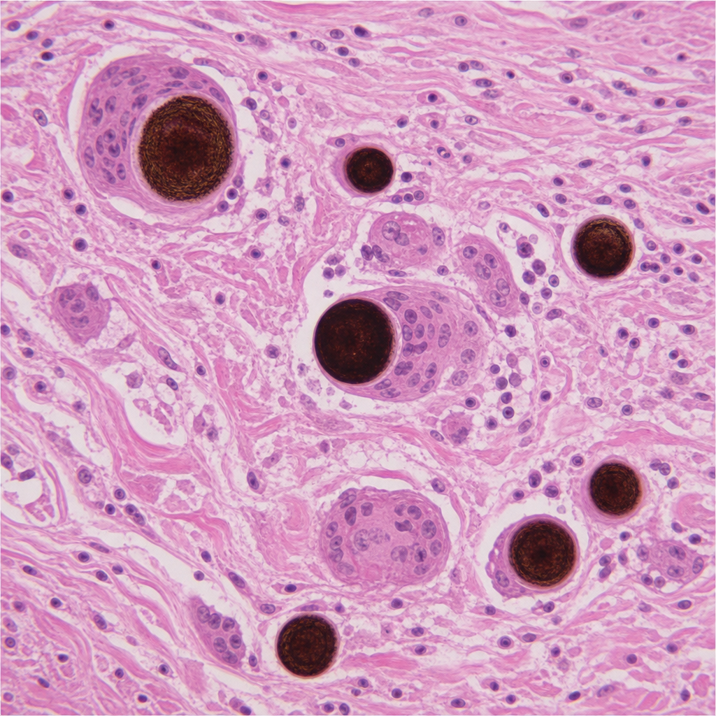 Image for question 88