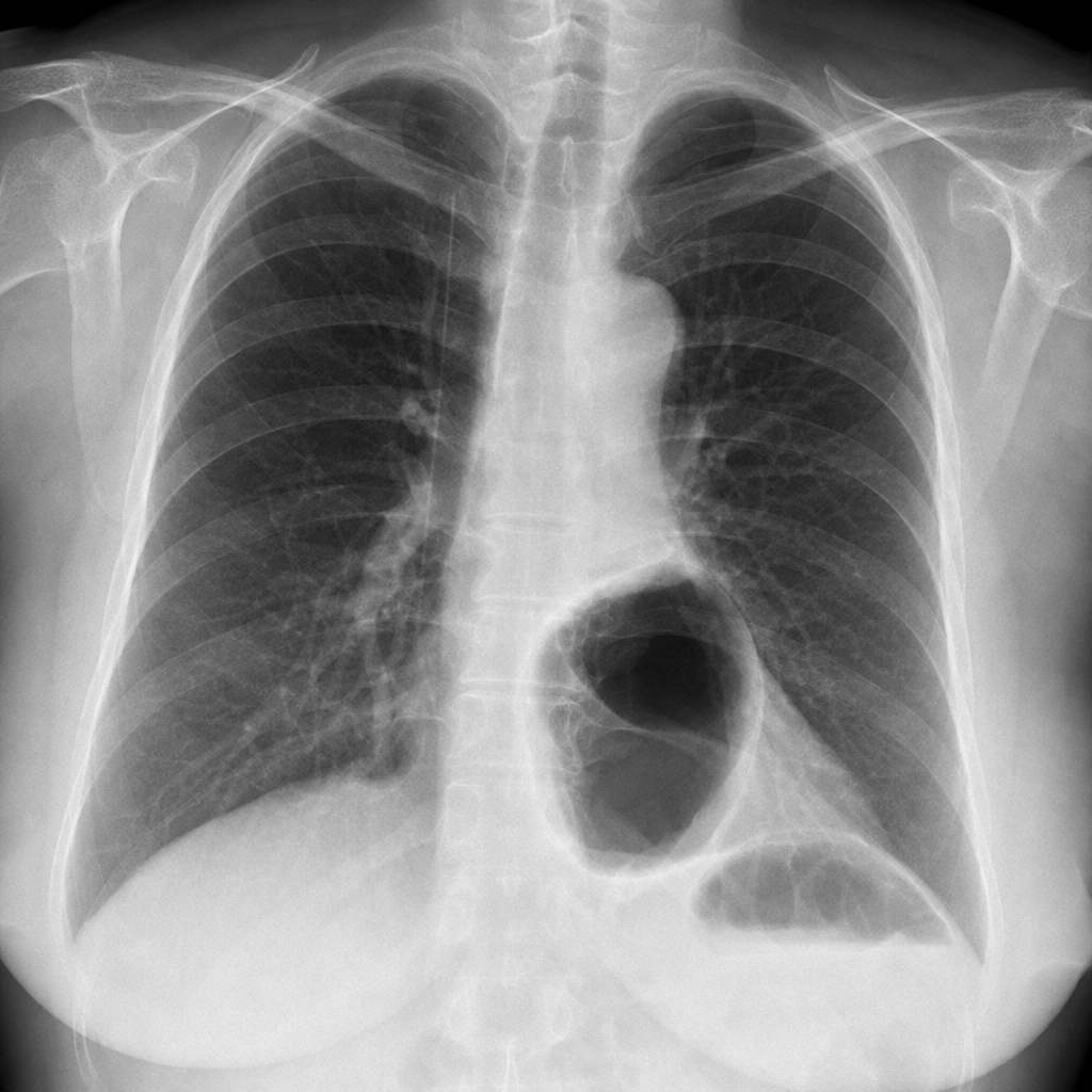 Image for question 72