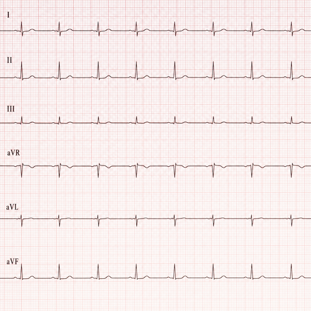 Image for question 299