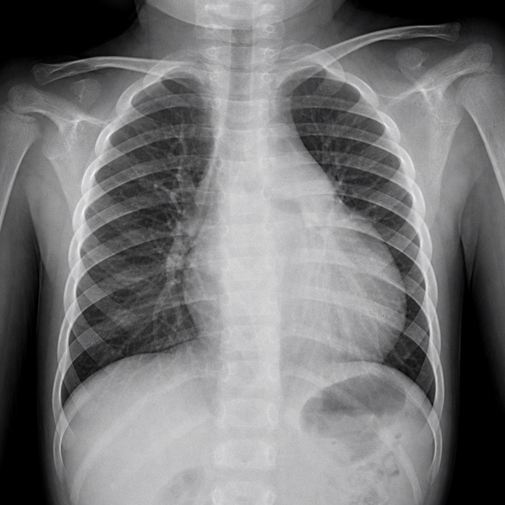 Image for question 167