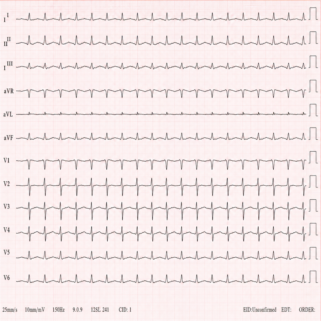 Image for question 1203