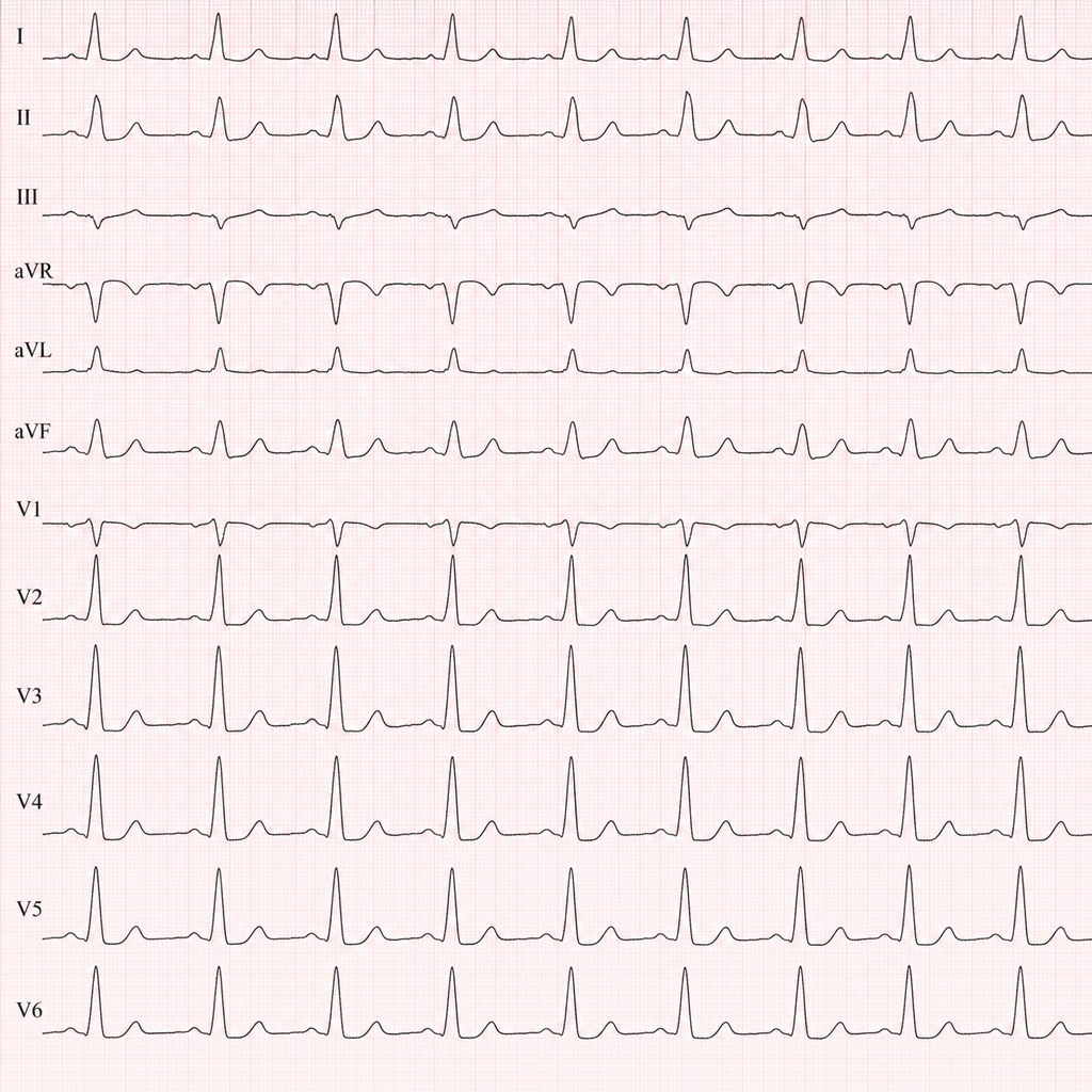 Image for question 47