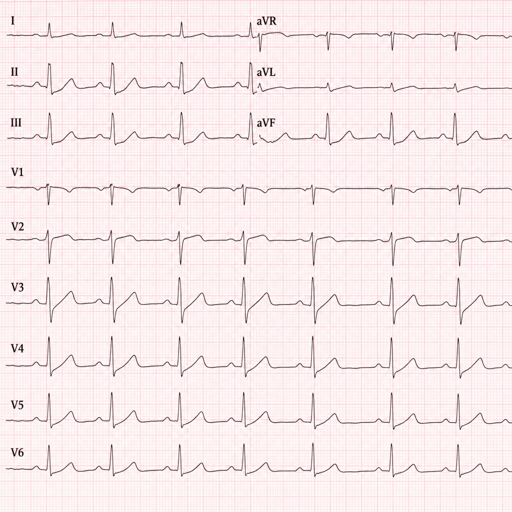 Image for question 2