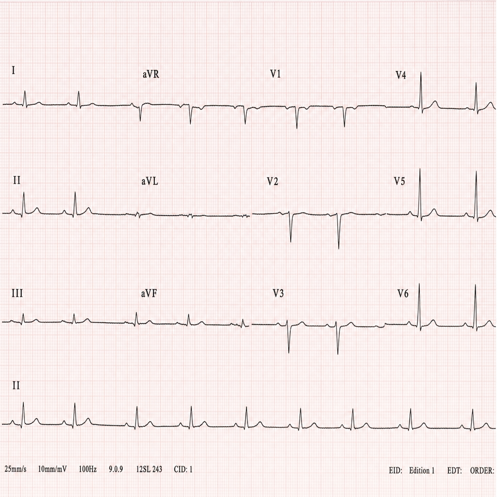 Image for question 2
