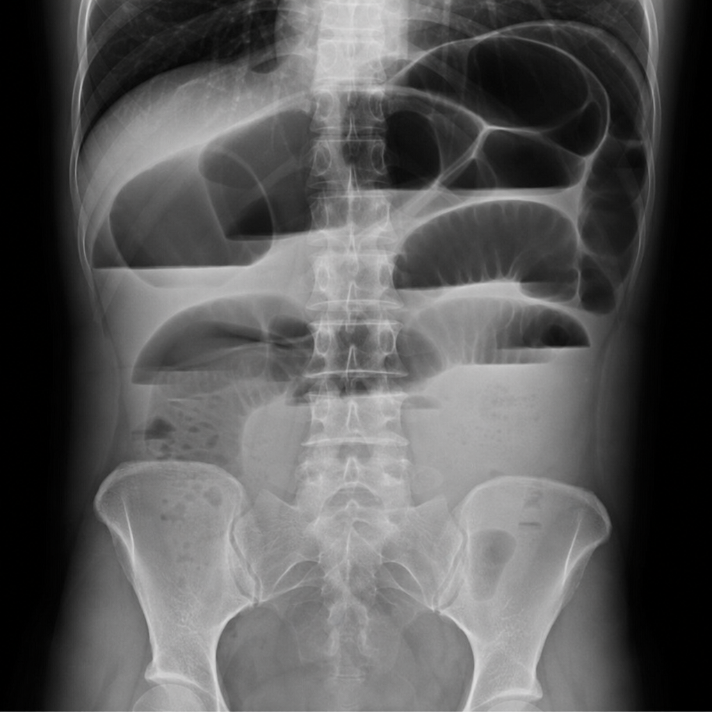Image for question 84