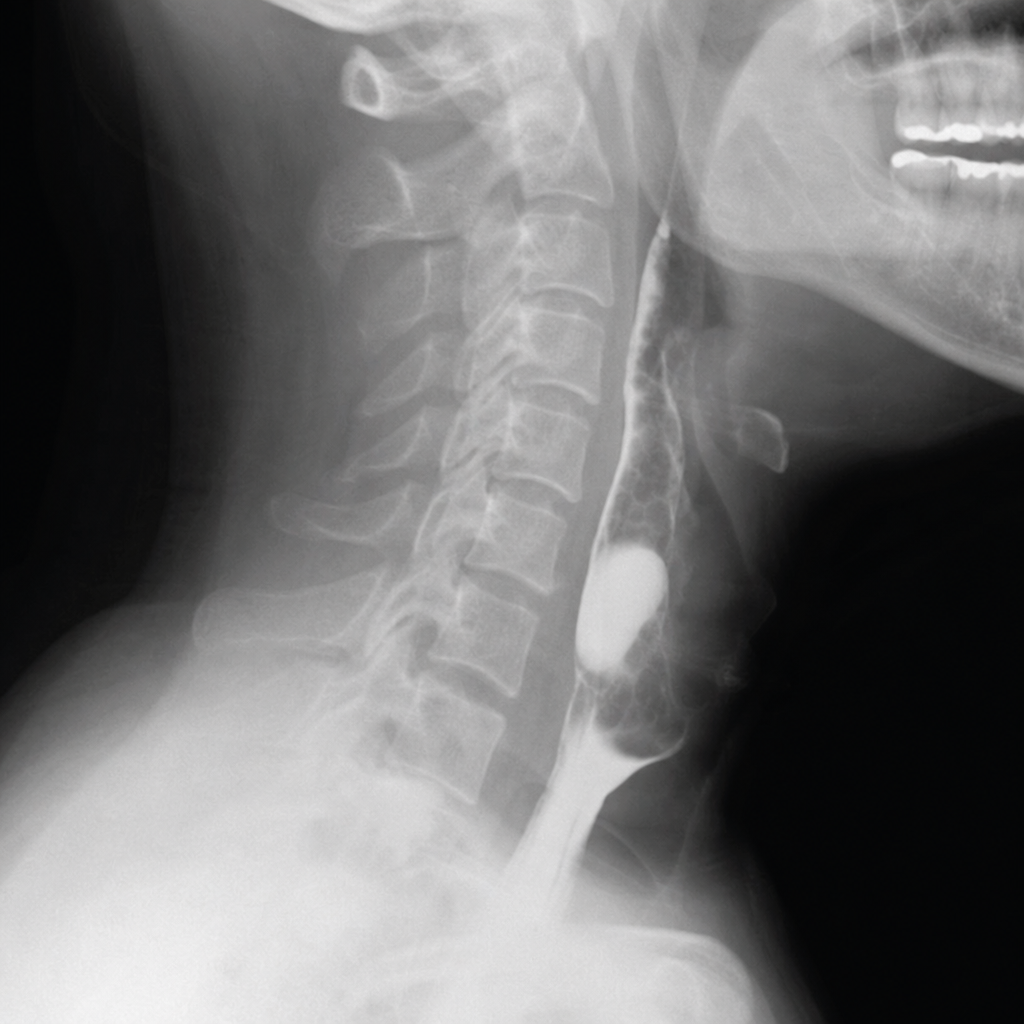 Image for question 330