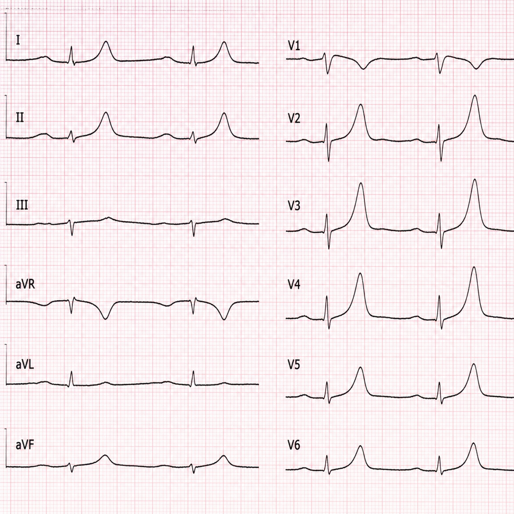 Image for question 114