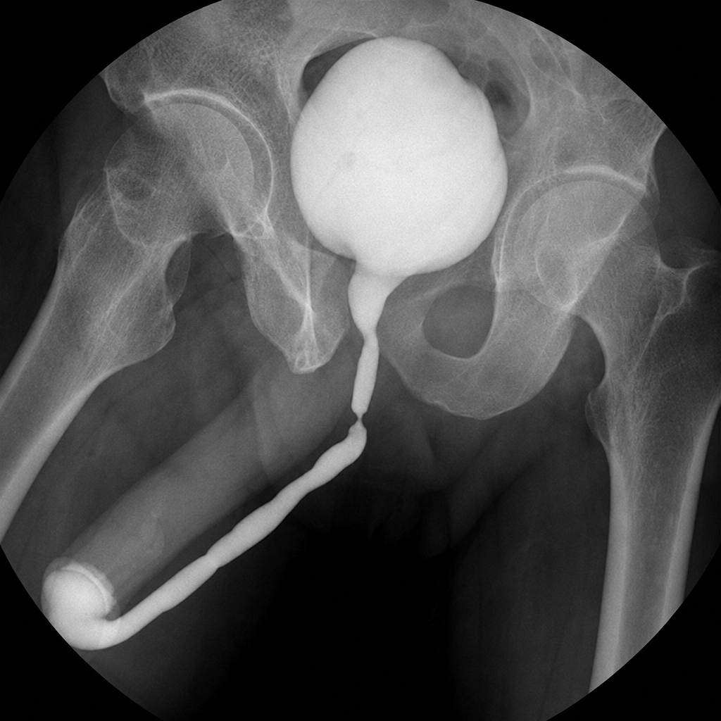 Image for question 337